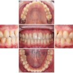 診療前の検査の大切さ