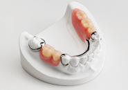 保険　義歯